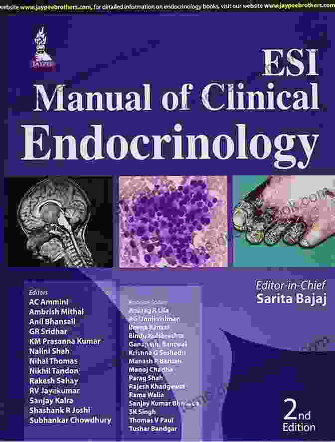 Modern Manual Of Endocrinology Book Cover Modern Manual Of Endocrinology S Balakrishnan